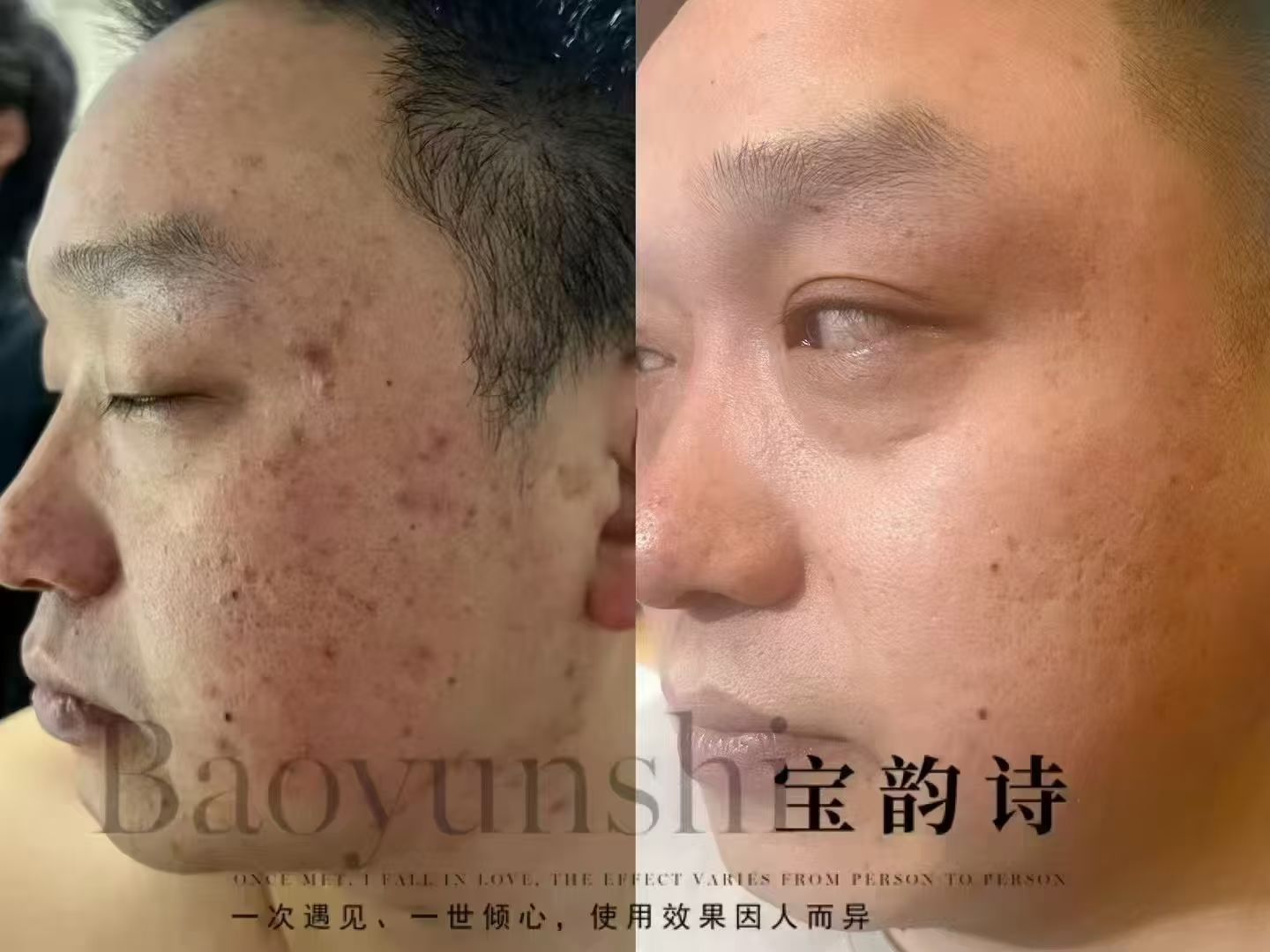 ☘
​没有文案，直接看照片[耶]