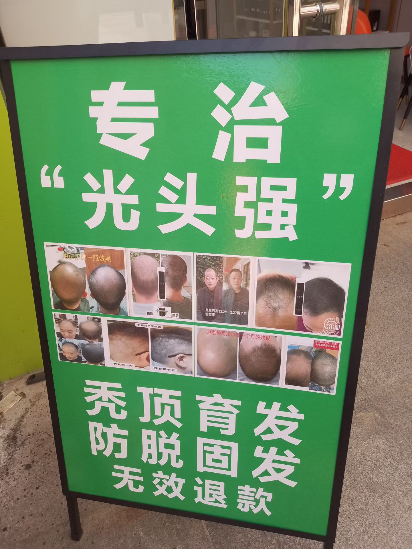 全城寻找50个光头，长出头发你买单，长不出头发我买单。