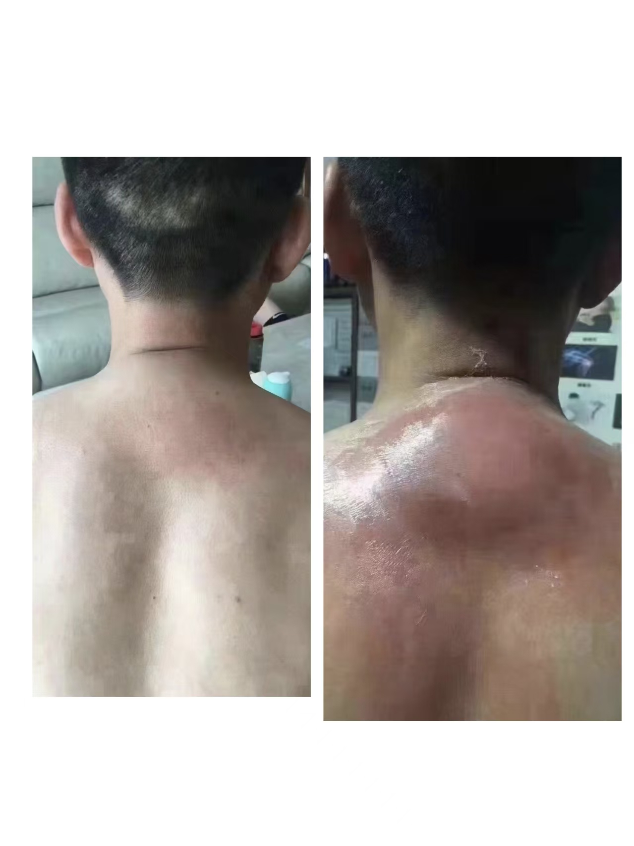 同康伊美一个月的效果