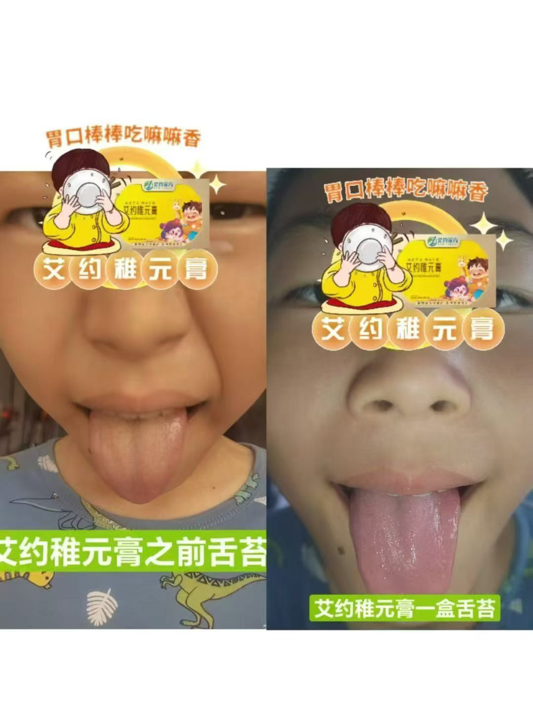 俊俊儿子舌苔从白到粉嫩
只用了1盒艾约稚元膏！👅

抱着试试看的心态喝了一盒，没想到效果居然这么明显