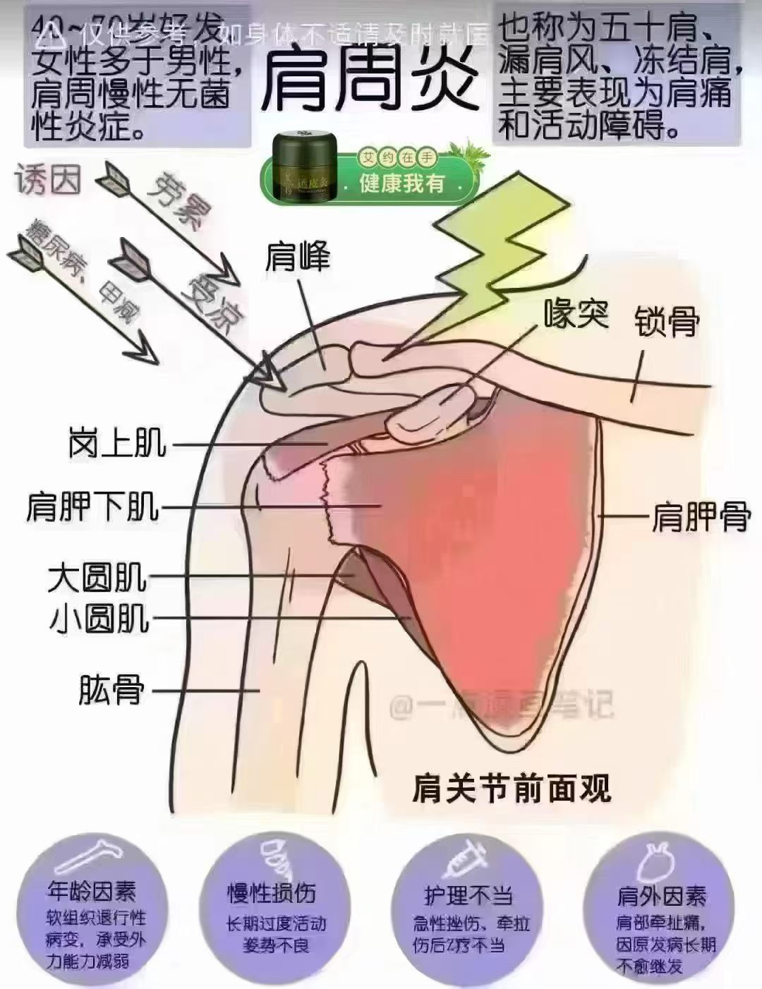[福]分享一下什么是肩周炎：
1：肩周炎、肩臂不举
2：肩臂不举、胳膊不能左右晃动
3：肩膀三侧疼痛