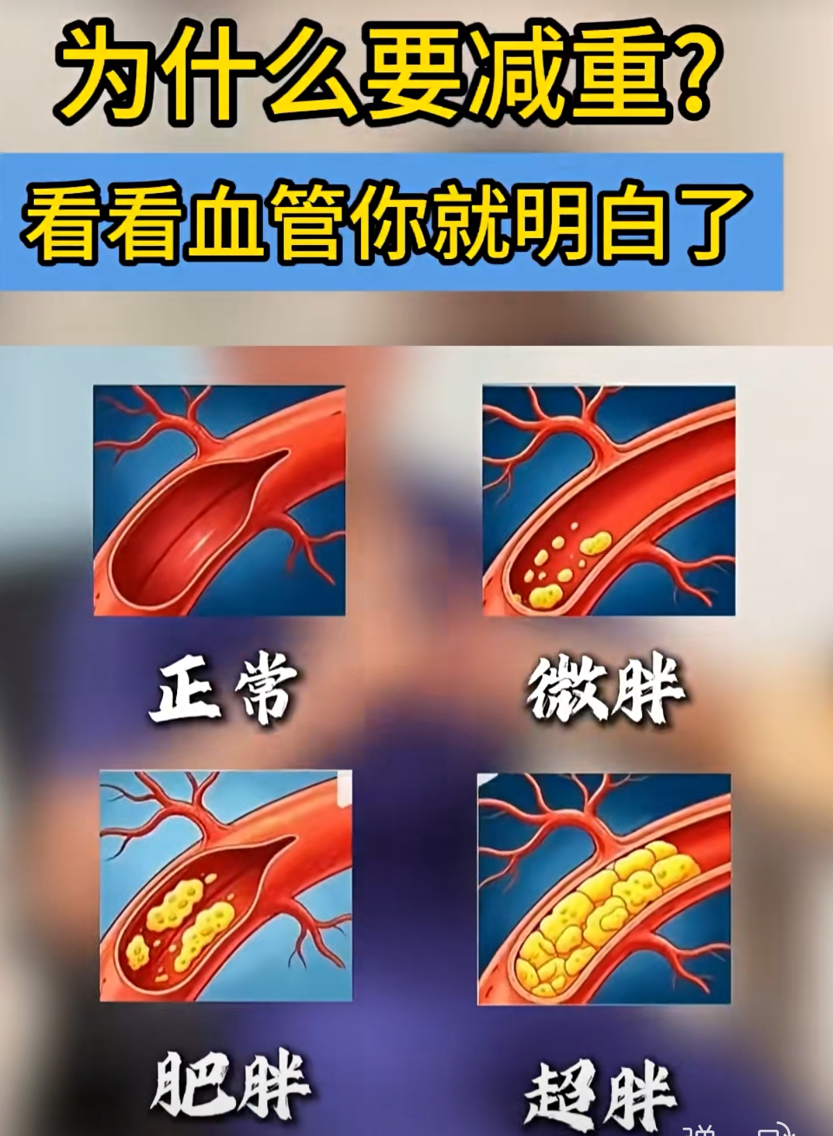 为什么要减重