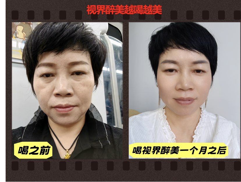 #视界醉美，健康逆龄一体化，口服不费力美到没脾气，以自然之恢复年轻态，#视界醉美越喝越美
