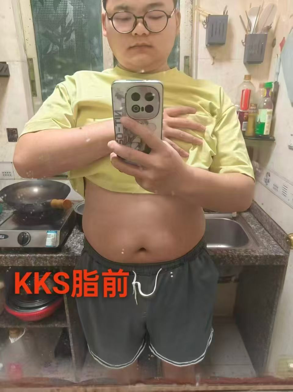 胖孩子二个月减了32斤，
KKS脂达人让身体越来越好，让 孩子找回信🌹🌹🌹❤️